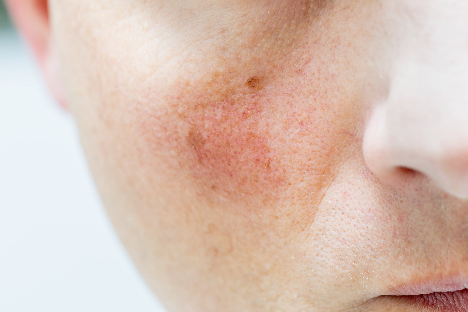 Double Cleansing for Sensitive Skin: A Gentle Guide
